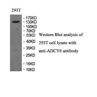 ADCY6 antibody (pAb)