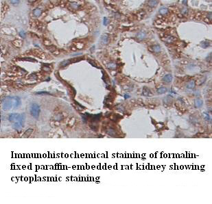 TUBB antibody (pAb) TUBB antibody (pAb)