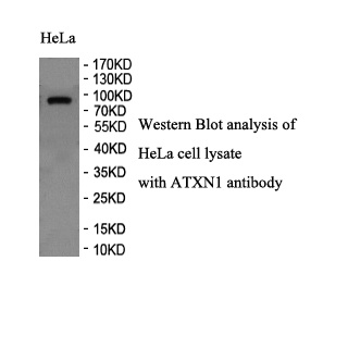 ATXN1 antibody (pAb) ATXN1 antibody (pAb)