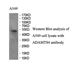 ADAMTS4 antibody (pAb) ADAMTS4 antibody (pAb)