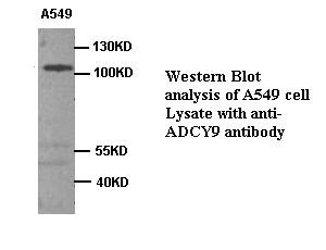 ADCY9 antibody (pAb)