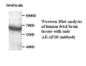 AKAP10 antibody (pAb)