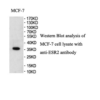 ESR2 antibody (pAb)