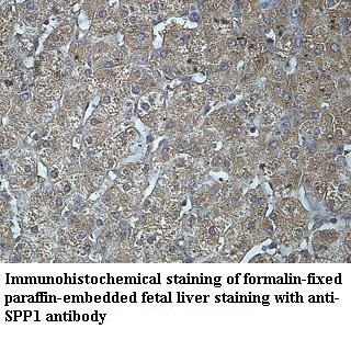 SPP1 antibody (pAb) SPP1 antibody (pAb)