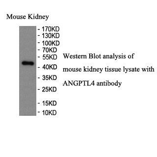 ANGPTL4 antibody (pAb)