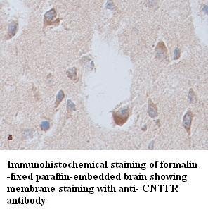 CNTFR antibody (pAb) CNTFR antibody (pAb)
