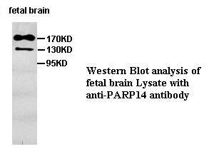 PARP14 antibody (pAb) PARP14 antibody (pAb)