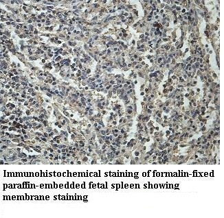 TNFRSF13B antibody (pAb) TNFRSF13B antibody (pAb)