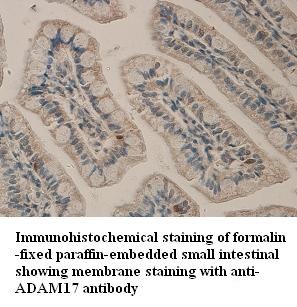 ADAM17 antibody (pAb) ADAM17 antibody (pAb)