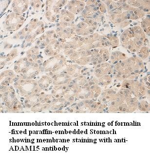 ADAM15 antibody (pAb)