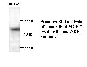 ADIPOR1 antibody (pAb)