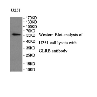 GLRB antibody (pAb) GLRB antibody (pAb)
