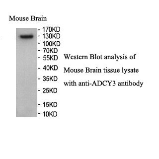 ADCY3 antibody (pAb)