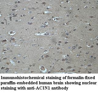 ACIN1 antibody (pAb)