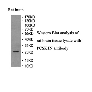 PCSK1N antibody (pAb) PCSK1N antibody (pAb)