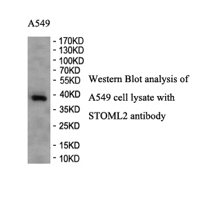 STOML2 antibody (pAb) STOML2 antibody (pAb)