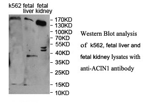 ACIN1 antibody (pAb)