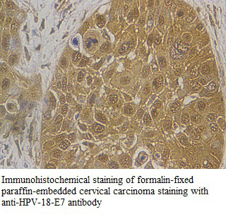 HPV18-E7 antibody (pAb) HPV18-E7 antibody (pAb)