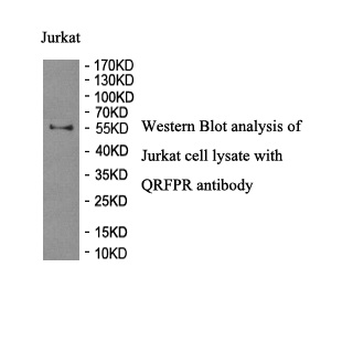 QRFPR antibody (pAb) QRFPR antibody (pAb)