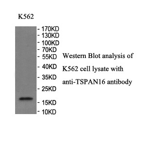 TSPAN16 antibody (pAb) TSPAN16 antibody (pAb)