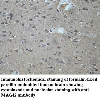 MAGI2 antibody (pAb)