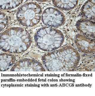 ABCG8 antibody (pAb)