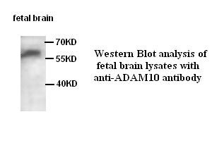 ADAM10 antibody (pAb) ADAM10 antibody (pAb)