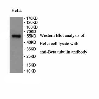 TUBB antibody (pAb) TUBB antibody (pAb)