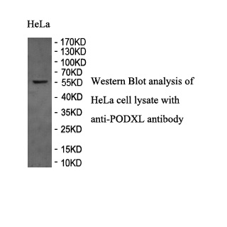 PODXL antibody (pAb) PODXL antibody (pAb)