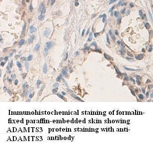 ADAMTS3 antibody (pAb)
