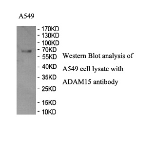ADAM15 antibody (pAb)