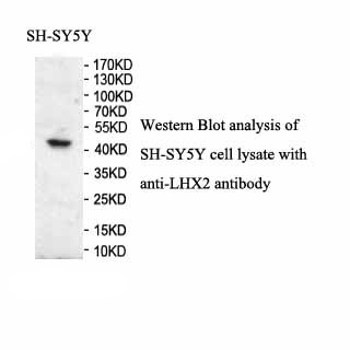 LHX2 antibody (pAb) LHX2 antibody (pAb)