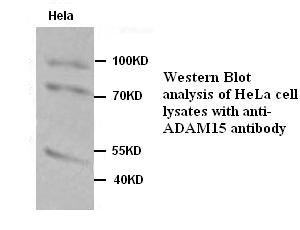 ADAM15 antibody (pAb)