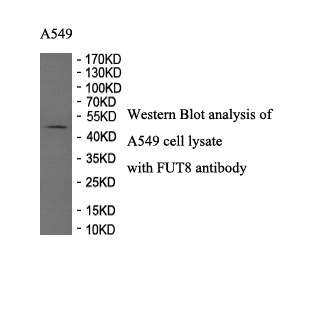 FUT8 antibody (pAb) FUT8 antibody (pAb)