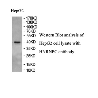 HNRNPC antibody (pAb) HNRNPC antibody (pAb)