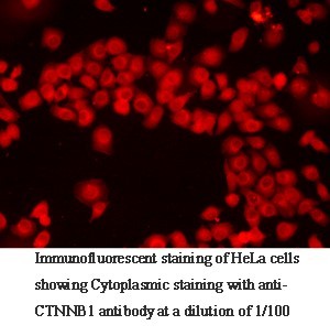 CTNNB1 antibody (pAb) CTNNB1 antibody (pAb)