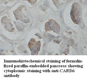 CARD6 antibody (pAb) CARD6 antibody (pAb)