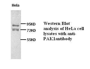 PAK1 antibody (pAb) PAK1 antibody (pAb)