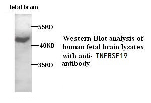 TNFRSF19 antibody (pAb)