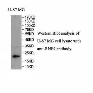 RNF4 antibody (pAb)