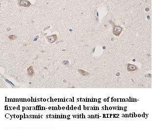 RIPK2 antibody (pAb) RIPK2 antibody (pAb)
