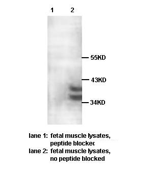 PARP11 antibody (pAb) PARP11 antibody (pAb)