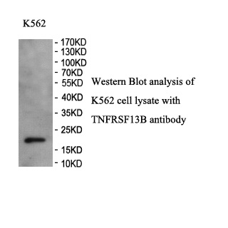 TNFRSF13B antibody (pAb)