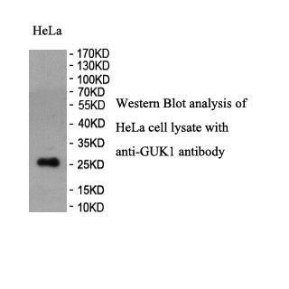 GUK1 antibody (pAb) GUK1 antibody (pAb)