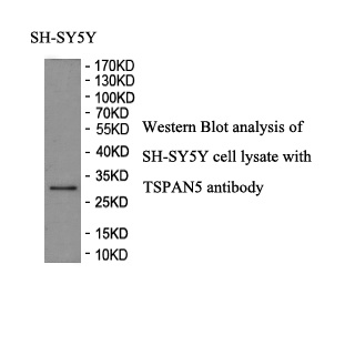 TSPAN5 antibody (pAb) TSPAN5 antibody (pAb)