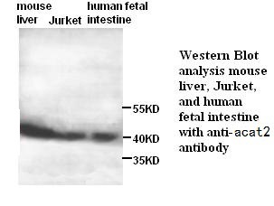 ACAT2 antibody (pAb)