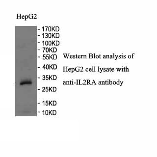IL2RA antibody (pAb) IL2RA antibody (pAb)