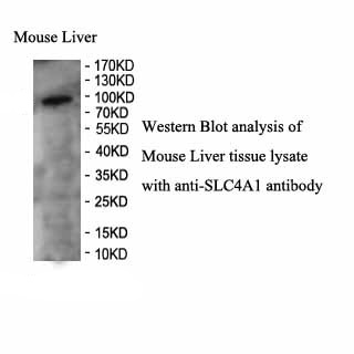SLC4A1 antibody (pAb) SLC4A1 antibody (pAb)