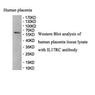 IL17RC antibody (pAb) IL17RC antibody (pAb)
