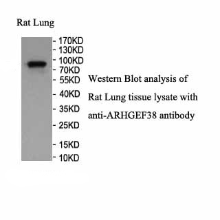 ARHGEF38 antibody (pAb) ARHGEF38 antibody (pAb)
